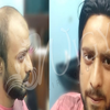 Men Hair wig shop in delhi